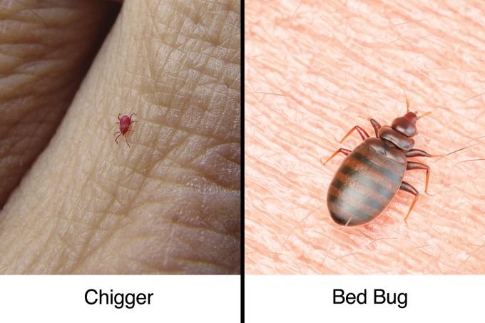 Differences Between Chigger Bites and Bed Bug Bites